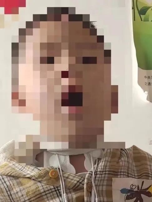 吞咽电疗仪怎么用【医讯】康复之路，让爱启航！深汕中心医院儿童神经康复中心为儿童健康保驾护航！_https://www.jmylbn.com_新闻资讯_第16张