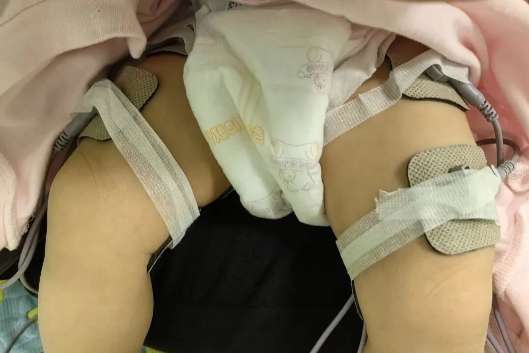 吞咽电疗仪怎么用【医讯】康复之路，让爱启航！深汕中心医院儿童神经康复中心为儿童健康保驾护航！_https://www.jmylbn.com_新闻资讯_第18张