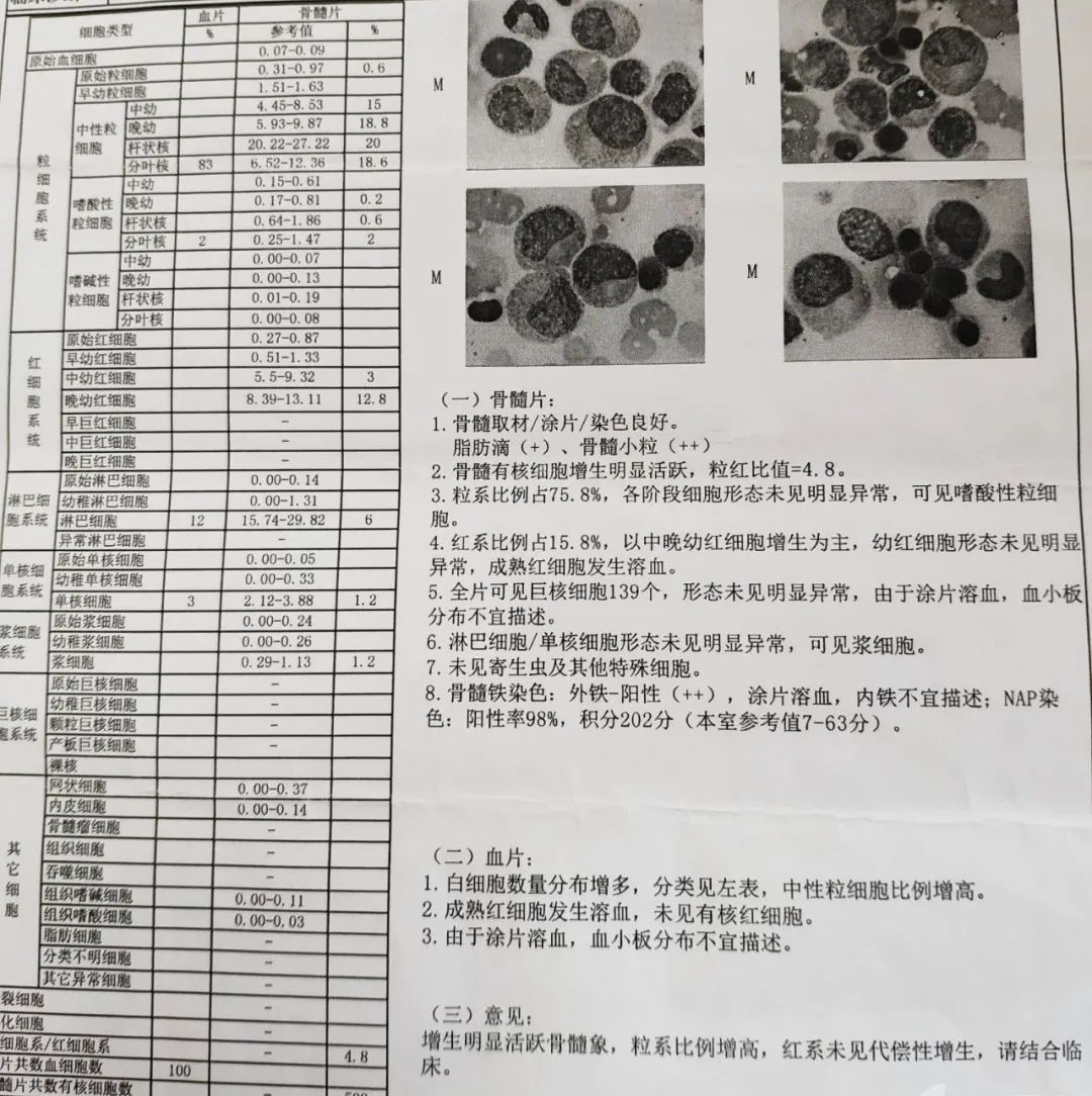 年輕小夥全身淋巴結破潰流膿，是誰在「啃食」他的身體？ 健康 第3張