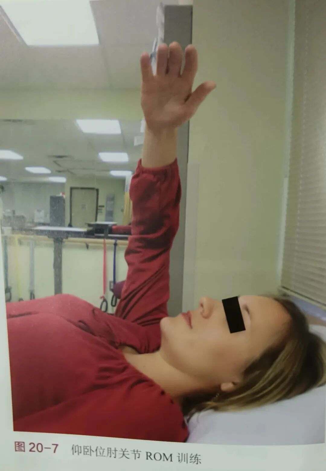 肘关节康复器怎么用肘关节骨折术后康复（一）_https://www.jmylbn.com_新闻资讯_第6张