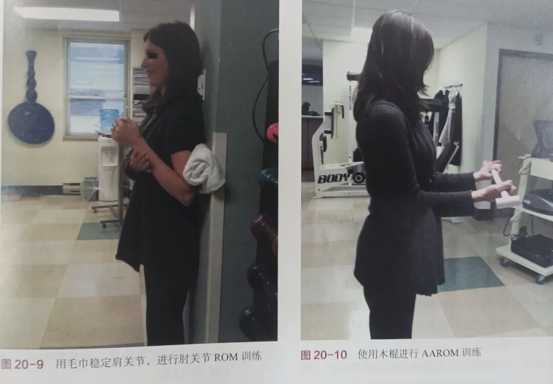 肘关节康复器怎么用肘关节骨折术后康复（一）_https://www.jmylbn.com_新闻资讯_第8张