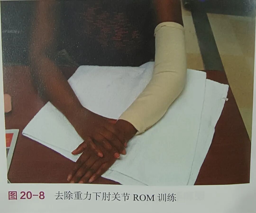 肘关节康复器怎么用肘关节骨折术后康复（一）_https://www.jmylbn.com_新闻资讯_第7张