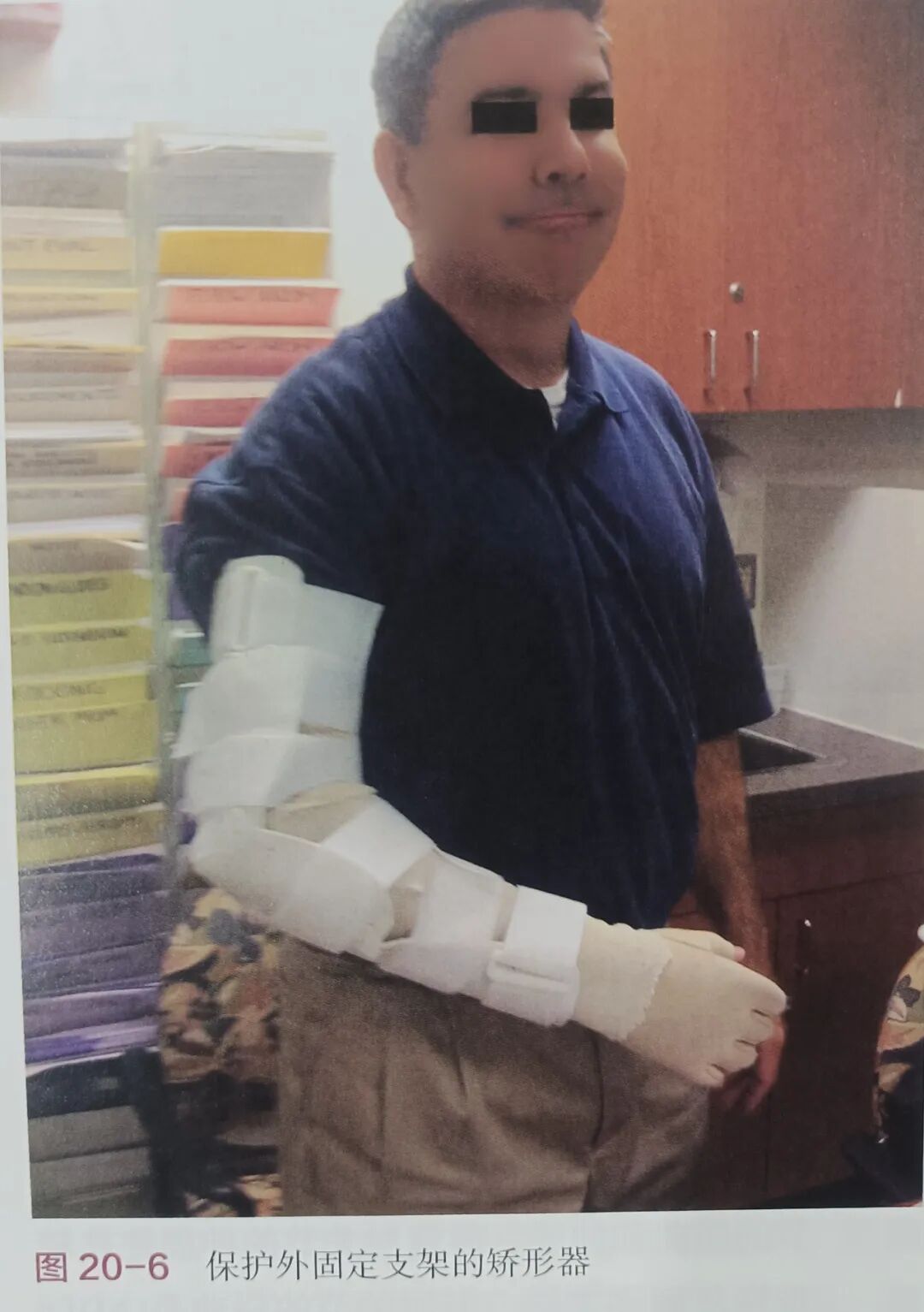 肘关节康复器怎么用肘关节骨折术后康复（一）_https://www.jmylbn.com_新闻资讯_第5张