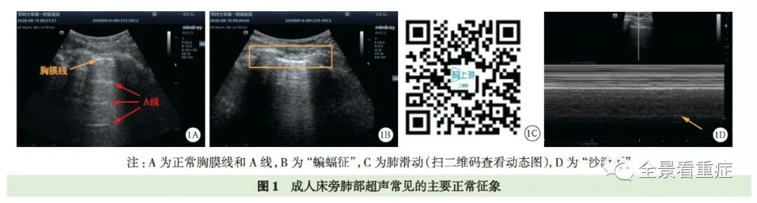 床旁x怎么使用基于循证的成人床旁超声护理专家共识（2020）_https://www.jmylbn.com_新闻资讯_第4张