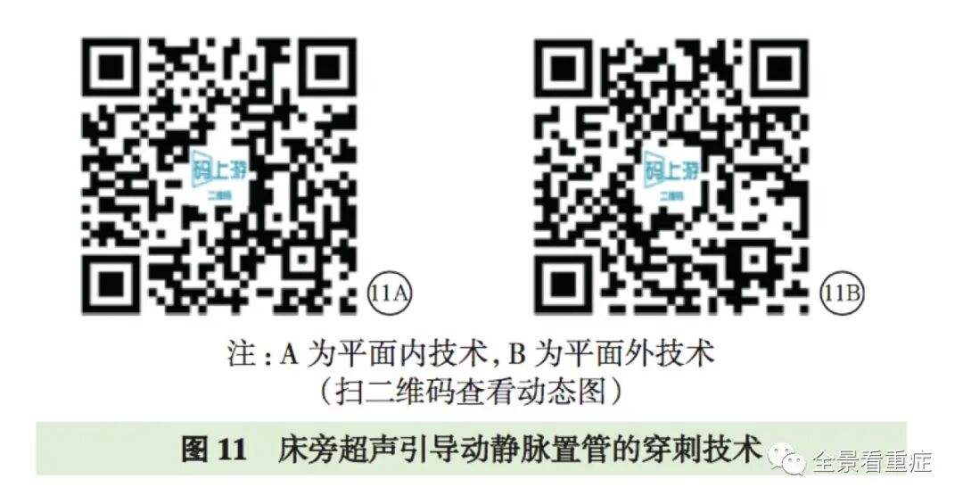 床旁x怎么使用基于循证的成人床旁超声护理专家共识（2020）_https://www.jmylbn.com_新闻资讯_第15张