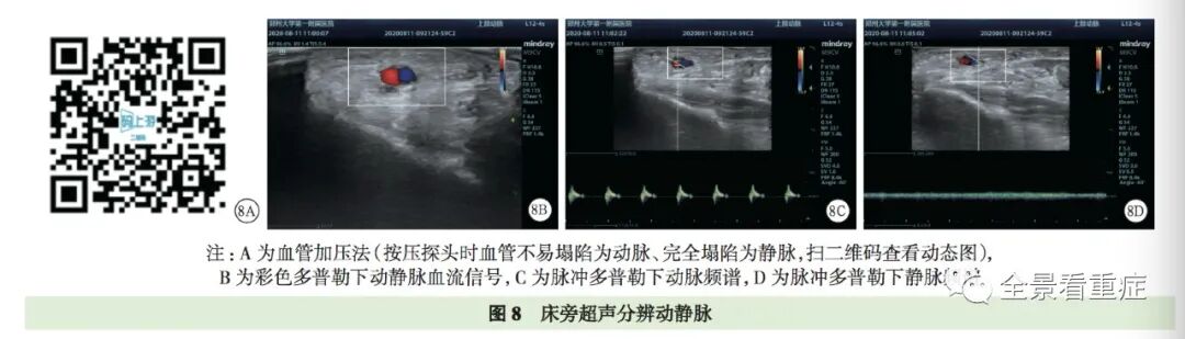 床旁x怎么使用基于循证的成人床旁超声护理专家共识（2020）_https://www.jmylbn.com_新闻资讯_第12张