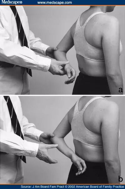 怎么评估病人肌力“肩 髋 膝 踝” 4大关节体格检查，干货速取！_https://www.jmylbn.com_新闻资讯_第14张