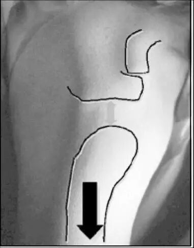 怎么评估病人肌力“肩 髋 膝 踝” 4大关节体格检查，干货速取！_https://www.jmylbn.com_新闻资讯_第20张