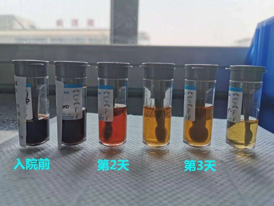 運動後出現以下表現要及時就醫