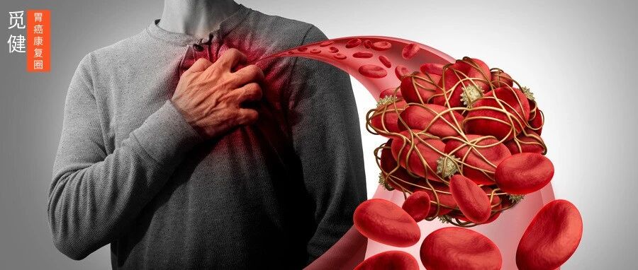 夺走癌症患者生命的并不总是癌细胞，还有这个隐秘的“杀手”