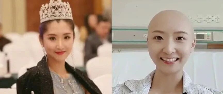 28岁舞蹈家苏日曼因胃癌去世，癌症为何缠上年轻人？