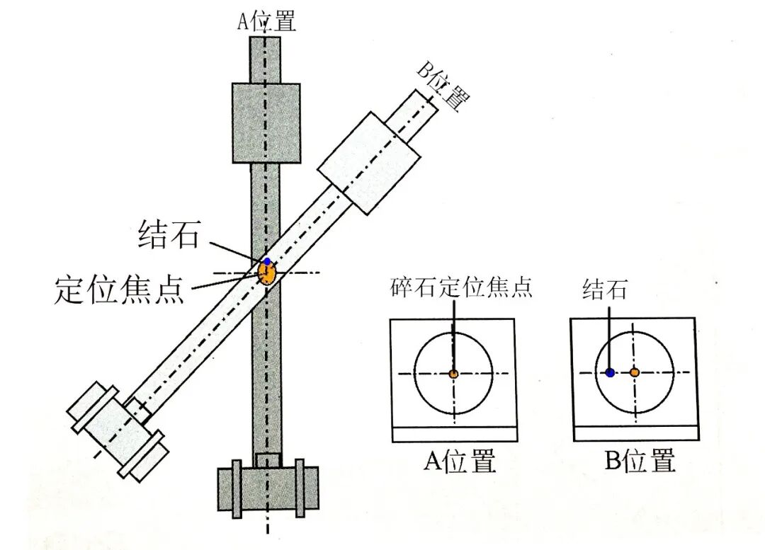 x光是什么原理分享‖体外碎石中X线与超声是如何定位结石的？_https://www.jmylbn.com_新闻资讯_第2张