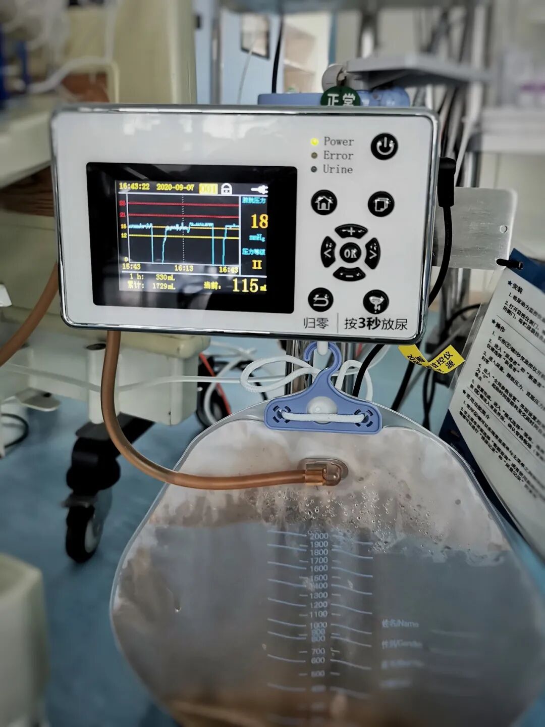 Icu护理设备有哪些揭秘ICU最常用的十大神器_https://www.jmylbn.com_新闻资讯_第11张