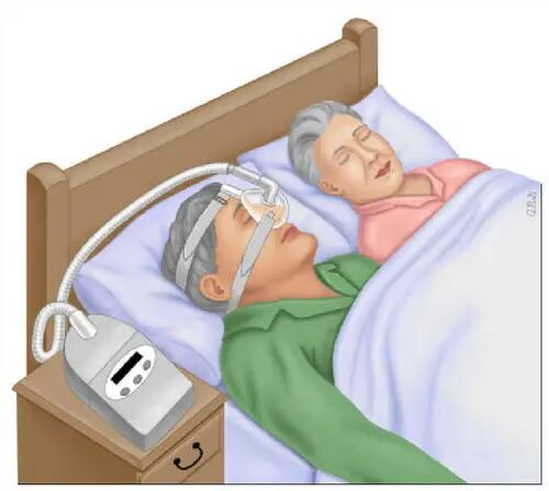 什么病要戴呼吸机「打呼噜」也是一种病！严重了可能有致命危害！睡前做好这一步轻松可预防！_https://www.jmylbn.com_新闻资讯_第4张