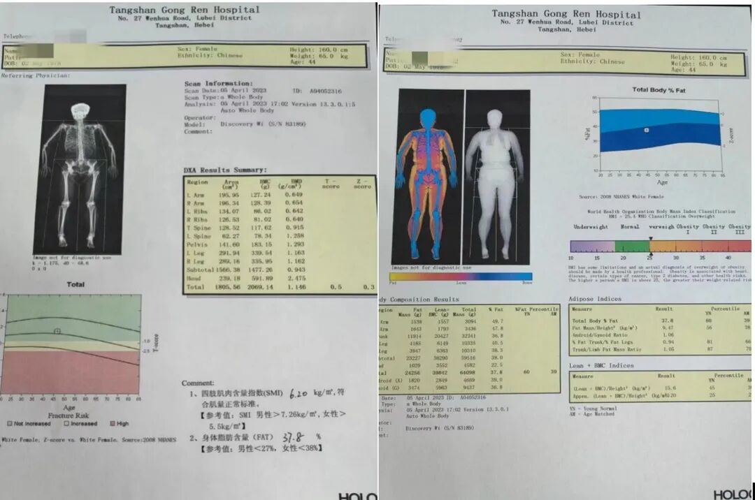 双能x骨密度检测仪为什么非得输入体重身高小心！千金难买老来瘦可能是病！——不信，来工人医院骨密度室做个体质分析检测吧_https://www.jmylbn.com_新闻资讯_第15张