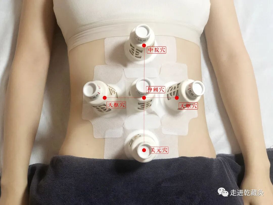 养生仪器怎么使用【学习篇】养生人必看：使用艾灸仪器与明火艾灸的区别？_https://www.jmylbn.com_新闻资讯_第4张