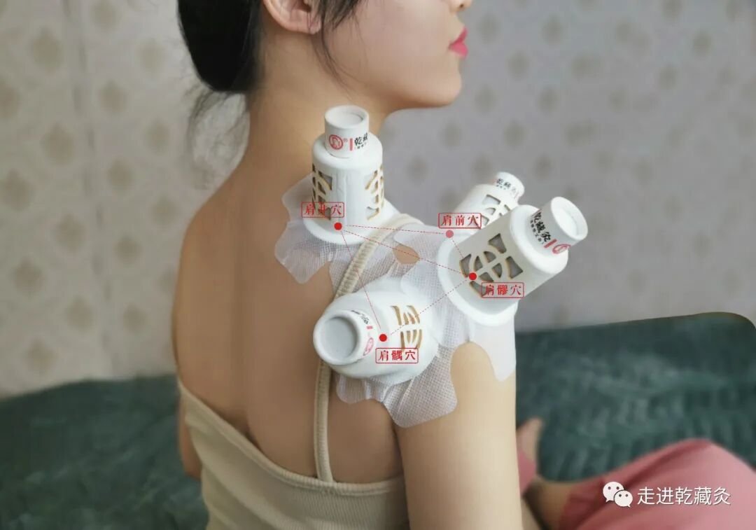 养生仪器怎么使用【学习篇】养生人必看：使用艾灸仪器与明火艾灸的区别？_https://www.jmylbn.com_新闻资讯_第6张