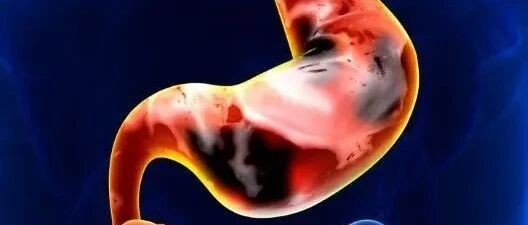 年内第3款一类新药报产，消化性溃疡药市场迎来 “上新”潮