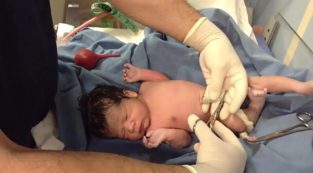 为什么剪脐带要先夹住新生儿是怎么剪断脐带？剪脐带时宝宝疼不疼？可能和你想的不一样_https://www.jmylbn.com_新闻资讯_第1张