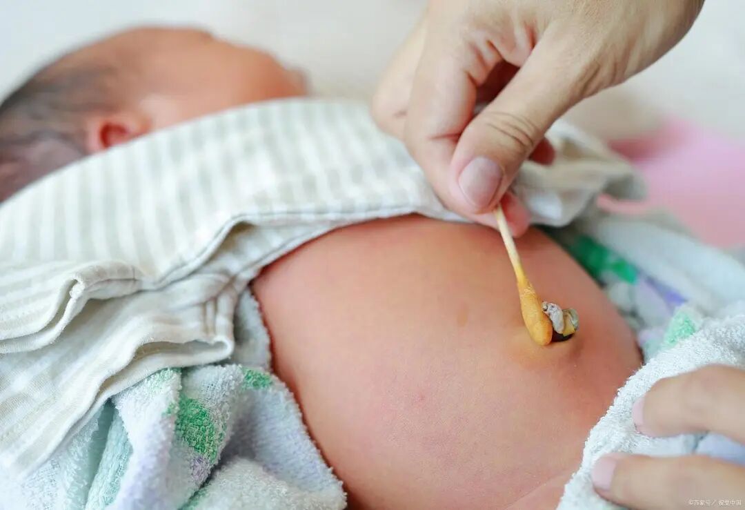 为什么剪脐带要先夹住新生儿是怎么剪断脐带？剪脐带时宝宝疼不疼？可能和你想的不一样_https://www.jmylbn.com_新闻资讯_第11张