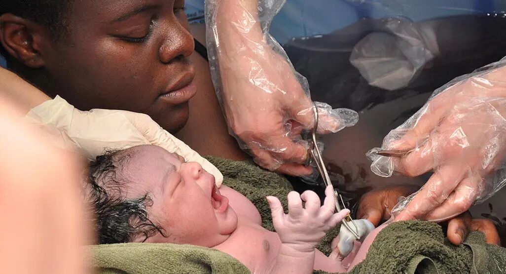 为什么剪脐带要先夹住新生儿是怎么剪断脐带？剪脐带时宝宝疼不疼？可能和你想的不一样_https://www.jmylbn.com_新闻资讯_第8张