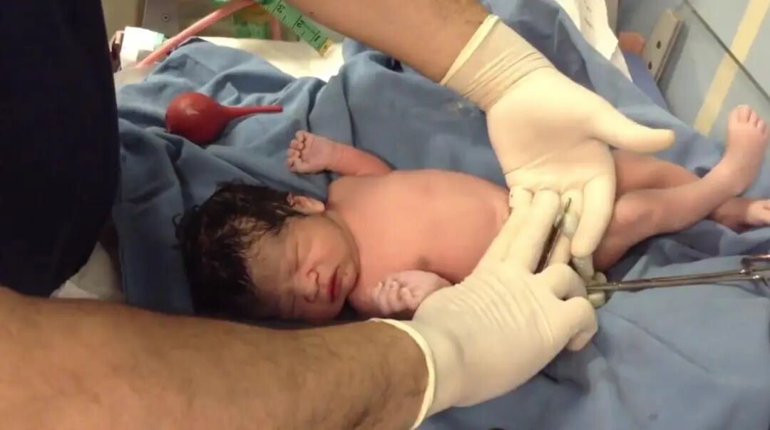 为什么剪脐带要先夹住新生儿是怎么剪断脐带？剪脐带时宝宝疼不疼？可能和你想的不一样_https://www.jmylbn.com_新闻资讯_第2张