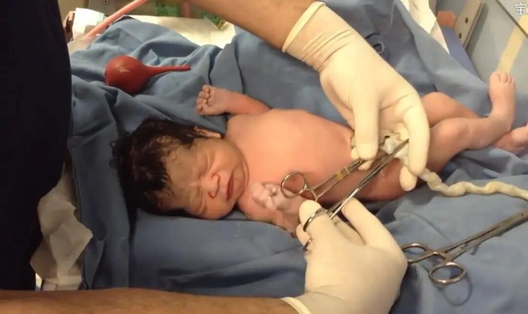 为什么剪脐带要先夹住新生儿是怎么剪断脐带？剪脐带时宝宝疼不疼？可能和你想的不一样_https://www.jmylbn.com_新闻资讯_第3张