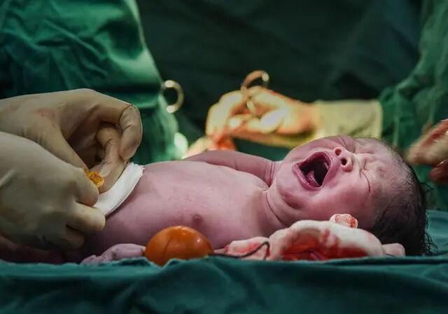 为什么剪脐带要先夹住新生儿是怎么剪断脐带？剪脐带时宝宝疼不疼？可能和你想的不一样_https://www.jmylbn.com_新闻资讯_第9张