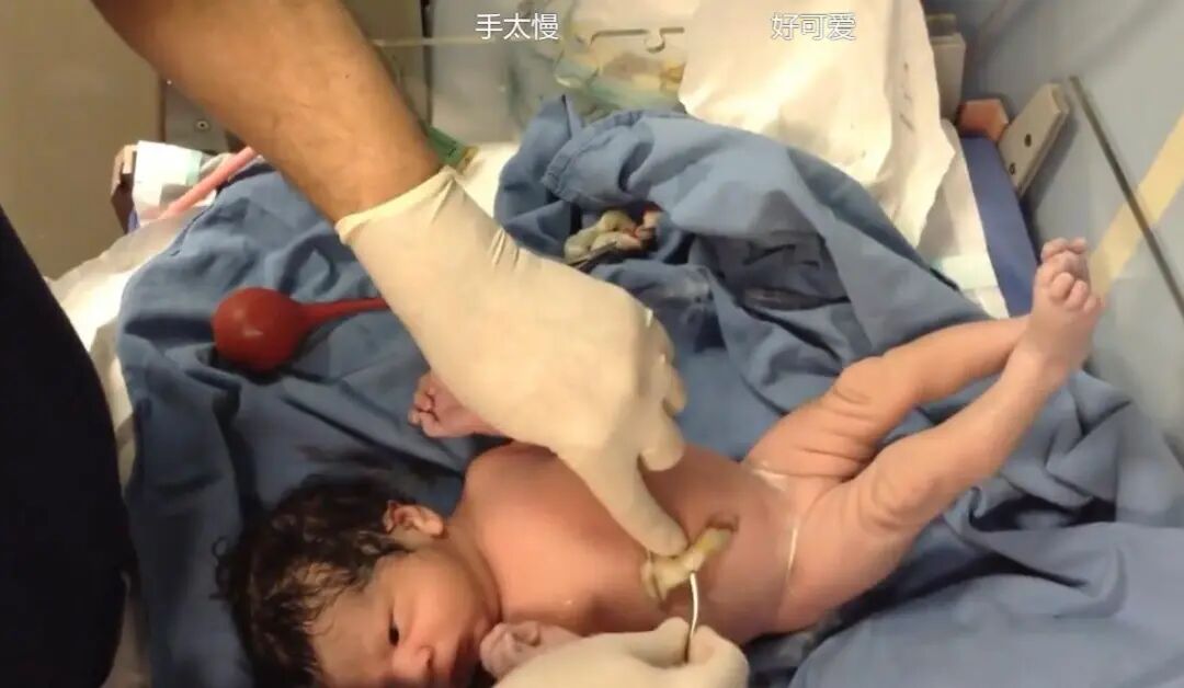 为什么剪脐带要先夹住新生儿是怎么剪断脐带？剪脐带时宝宝疼不疼？可能和你想的不一样_https://www.jmylbn.com_新闻资讯_第4张