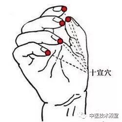 古法经络|手指麻木怎么调？试试这三个穴位！