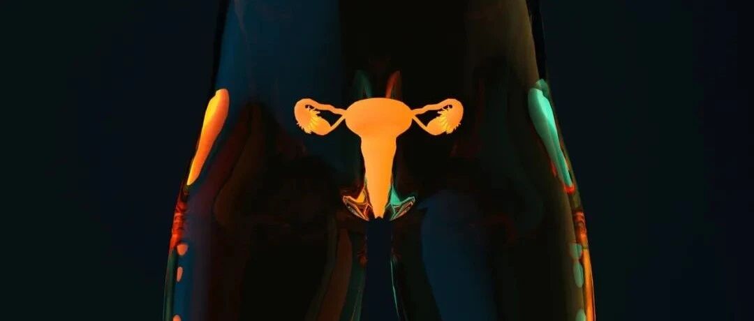 5表速览权威专家共识：初诊卵巢癌BRCA突变/HRR缺陷的检测