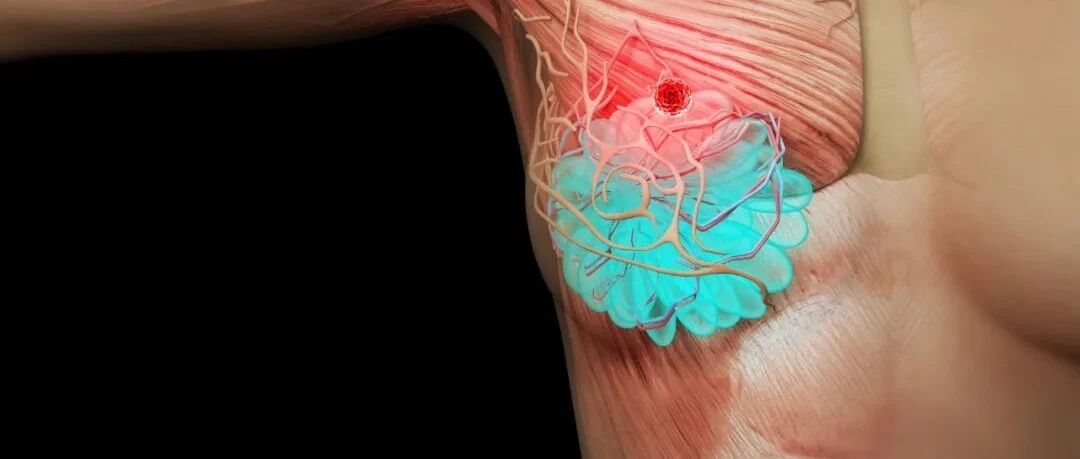 中国之声：复旦分型“精准”指导，免疫联合疗法用于CD8阳性TNBC有效率达81.3%