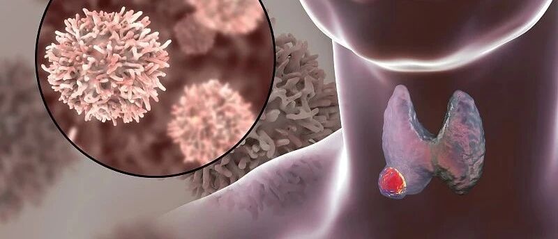 张彬教授丨 ASCO 2020：Pralsetinib精准突破RET+甲状腺癌的治疗困境