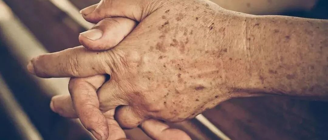 背上长斑，胃里长癌？——医生提醒：这种“老年斑”，一定要警惕！