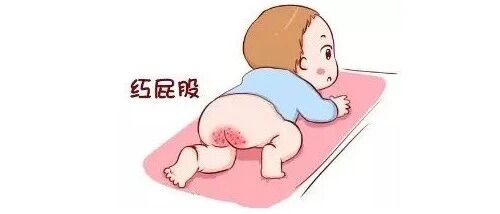 夏天小女孩总说屁屁痒，怎么回事？