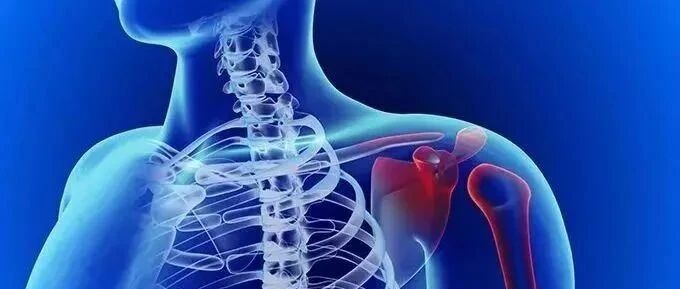 肩痛全赖我？肩周炎：这锅不独背