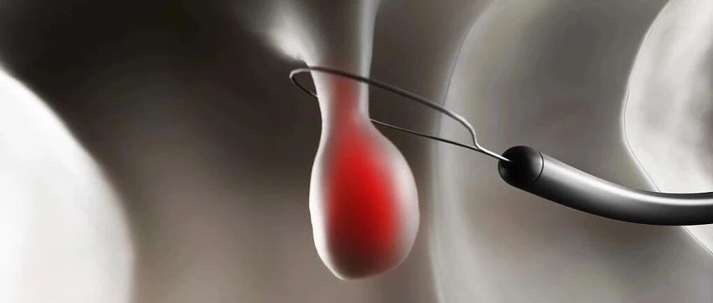 胃肠息肉是怎么长出来的？有什么危害？如何预防和治疗？