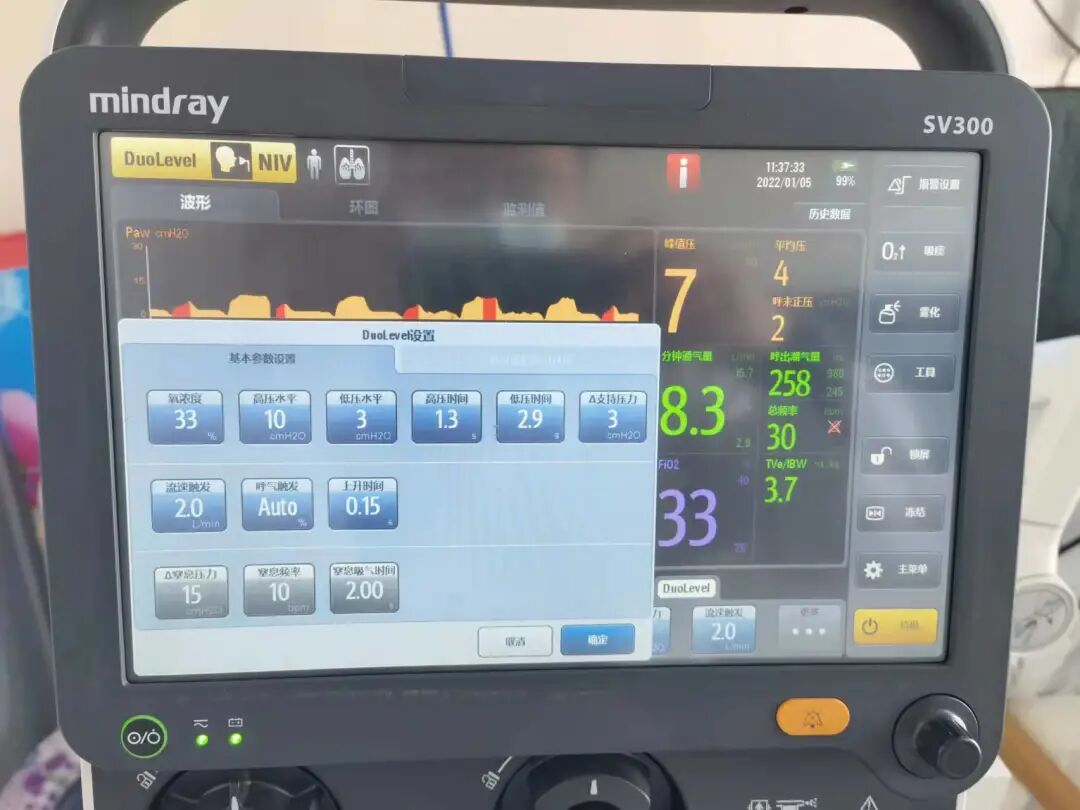 什么病要用呼吸机【医院动态】呼吸系统疾病首选无创呼吸机----我院内一科临床应用无创呼吸机抢救回垂危老人生命_https://www.jmylbn.com_新闻资讯_第2张