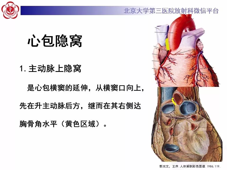 心包窦及心包隐窝的解剖结构