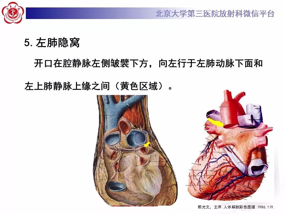 心包窦及心包隐窝的解剖结构