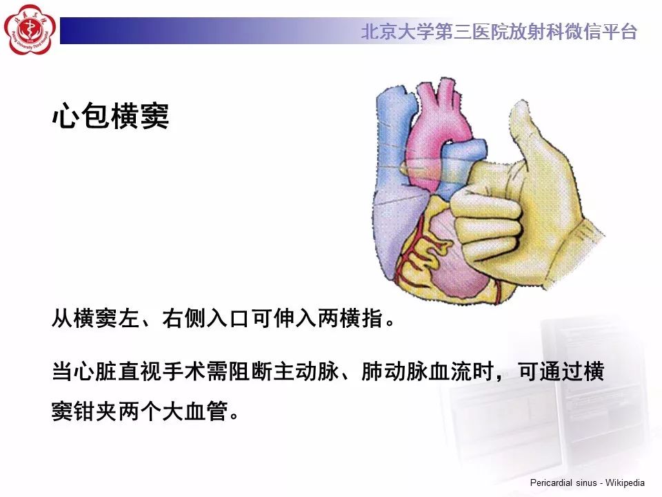 心包窦及心包隐窝的解剖结构