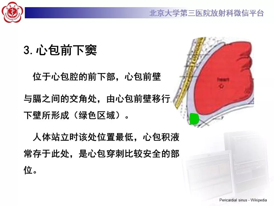 心包窦及心包隐窝的解剖结构