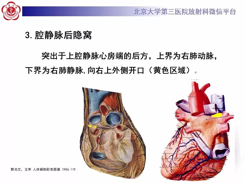 心包窦及心包隐窝的解剖结构