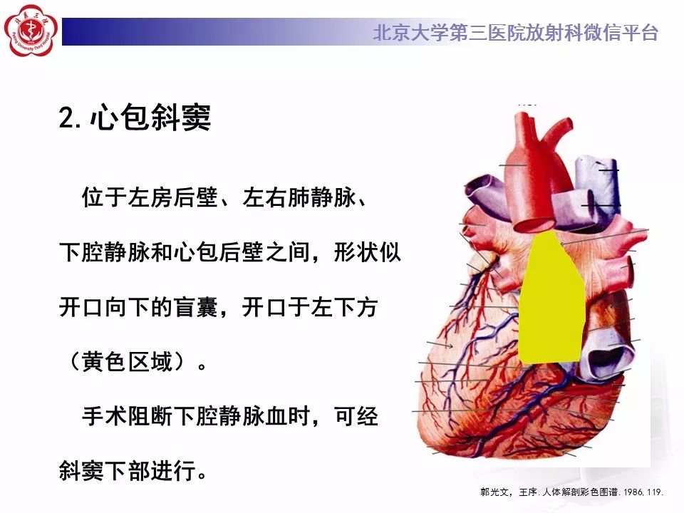 心包窦及心包隐窝的解剖结构