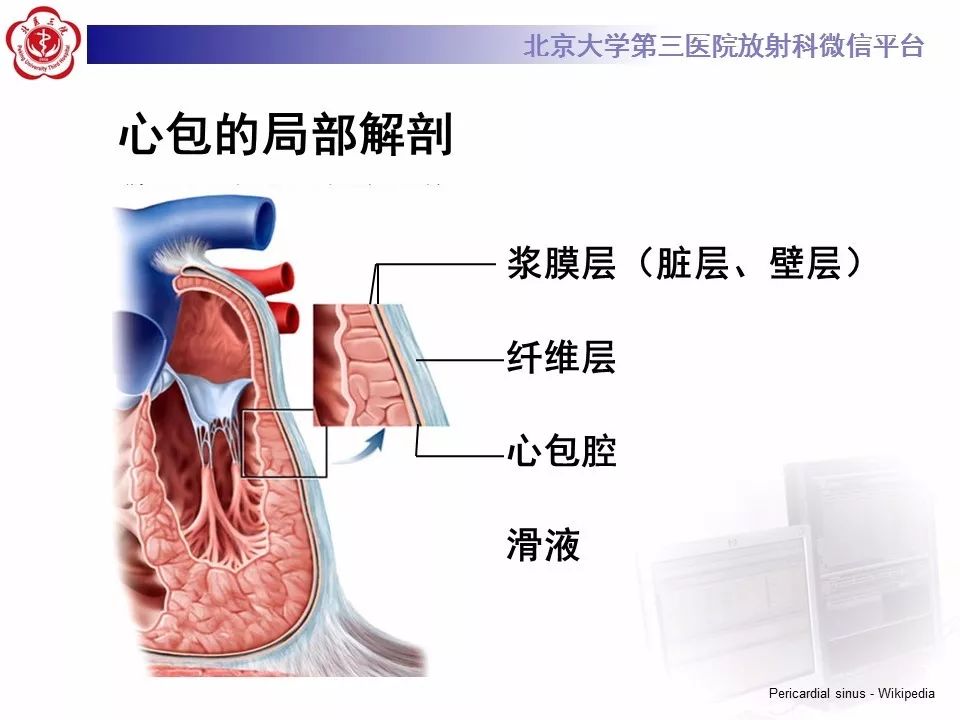 心包窦及心包隐窝的解剖结构