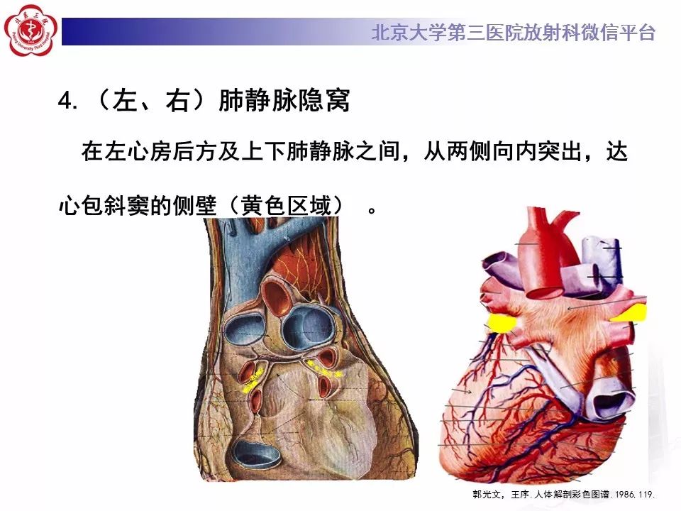 心包窦及心包隐窝的解剖结构