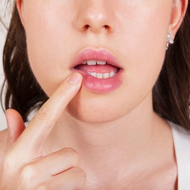 口腔溃疡反反复复要担心吗？能做什么来缓解疼痛？