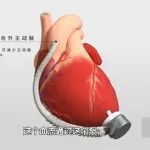 【阜外 • 媒体聚焦】北京卫视《我是大医生》为您揭秘没有心跳的人生！