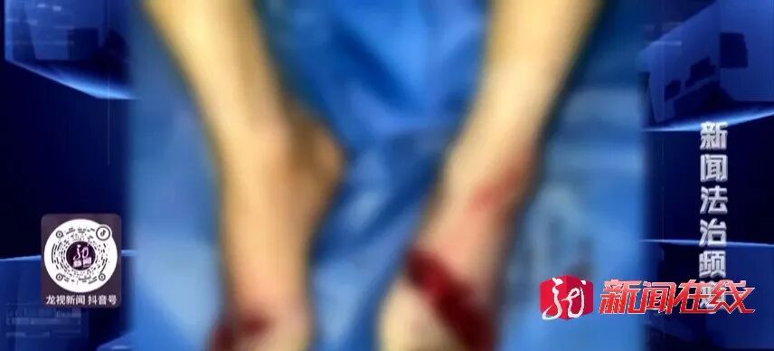 哈尔滨 三吨钢板空中落下，重重地砸在他的脚上！