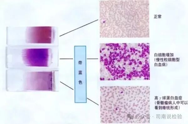 医用染色架 怎么用你问我答145：如何进行染色（瑞氏染色和吉姆萨染色）？_https://www.jmylbn.com_新闻资讯_第7张